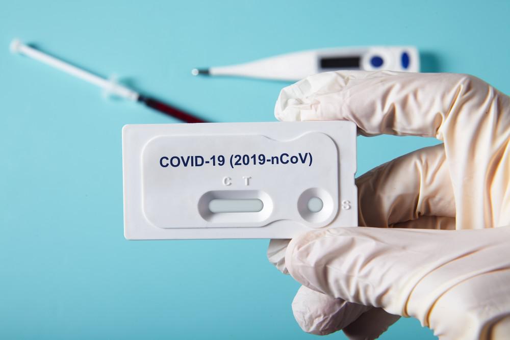 I Think I Have COVID-19: Should I Get Tested or Stay Home?